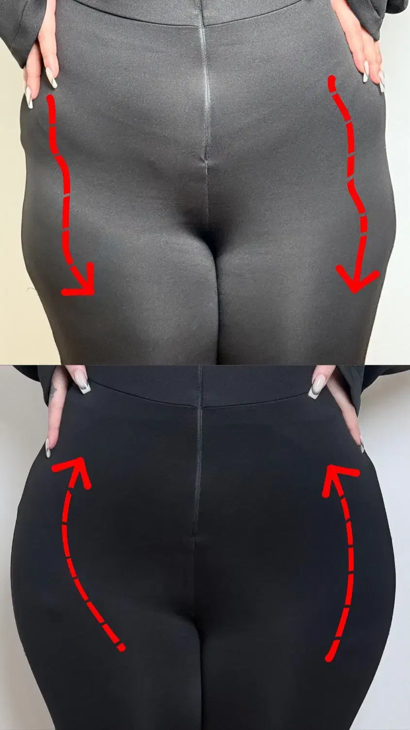 فیلربادی با تخفیف ۵۰٪در کلینیک مهرزاد|خدمات آرایشگری و زیبایی|تهران, جردن|دیوار