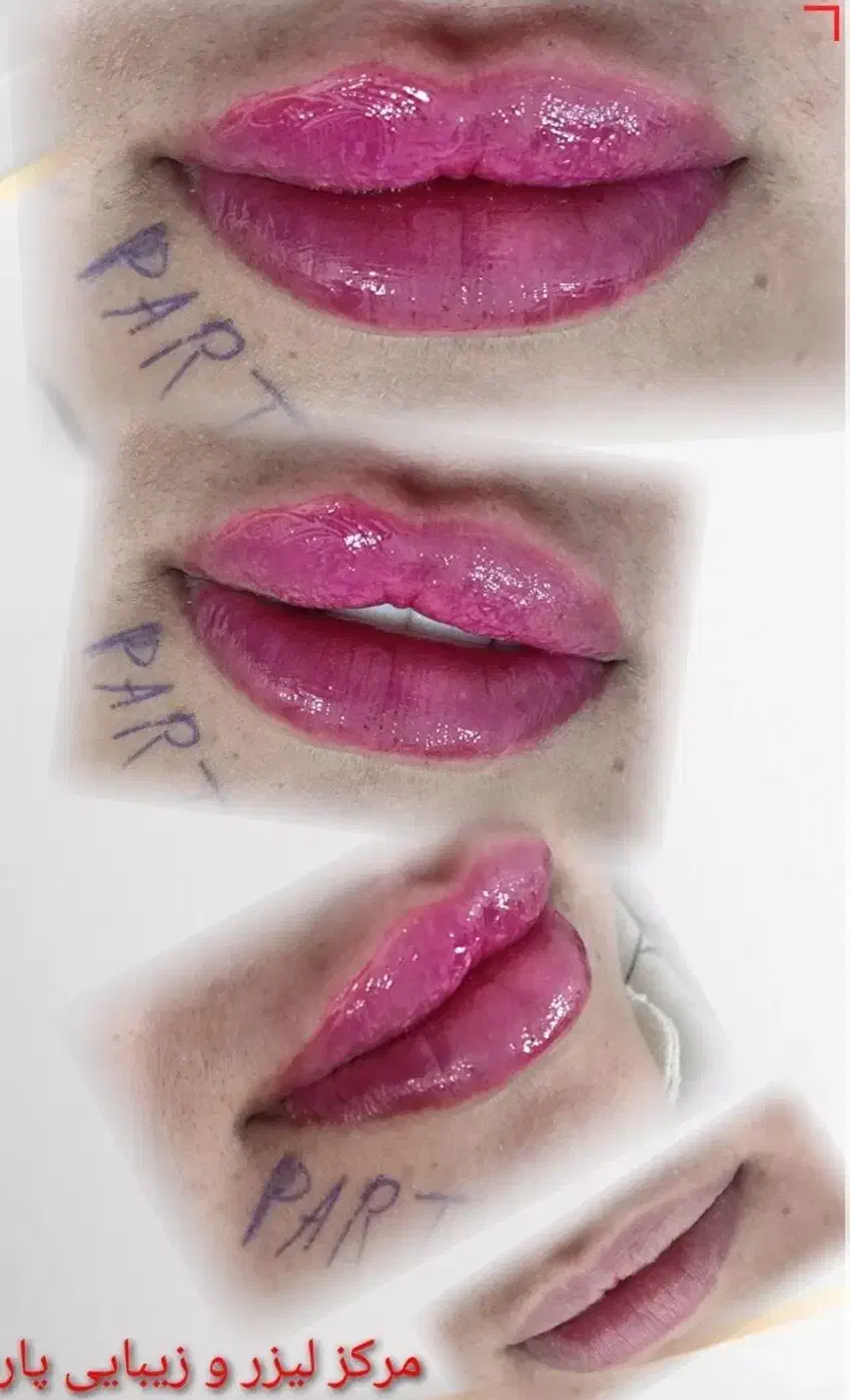 خدمات زیبایی بهترین نتایج با قیمت مناسب .ژل|خدمات آرایشگری و زیبایی|دوگنبدان, |دیوار