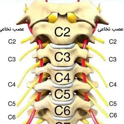 راهنمایی دیسک گردن|فعالیت داوطلبانه|شهرکرد, |دیوار