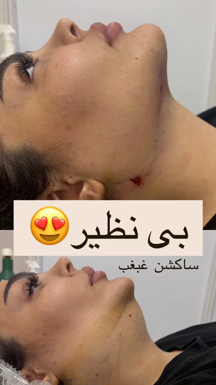 خدمات زیبایی و درمانی کلینیک تحصصی|خدمات آرایشگری و زیبایی|اهواز, پادادشهر|دیوار