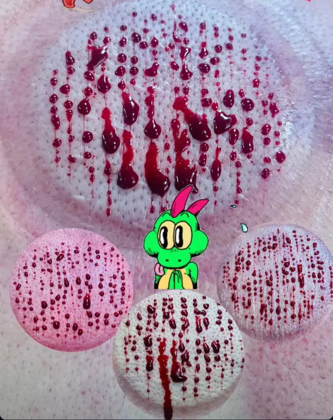 حجامت،فصد،زالو|خدمات آرایشگری و زیبایی|یاسوج, |دیوار