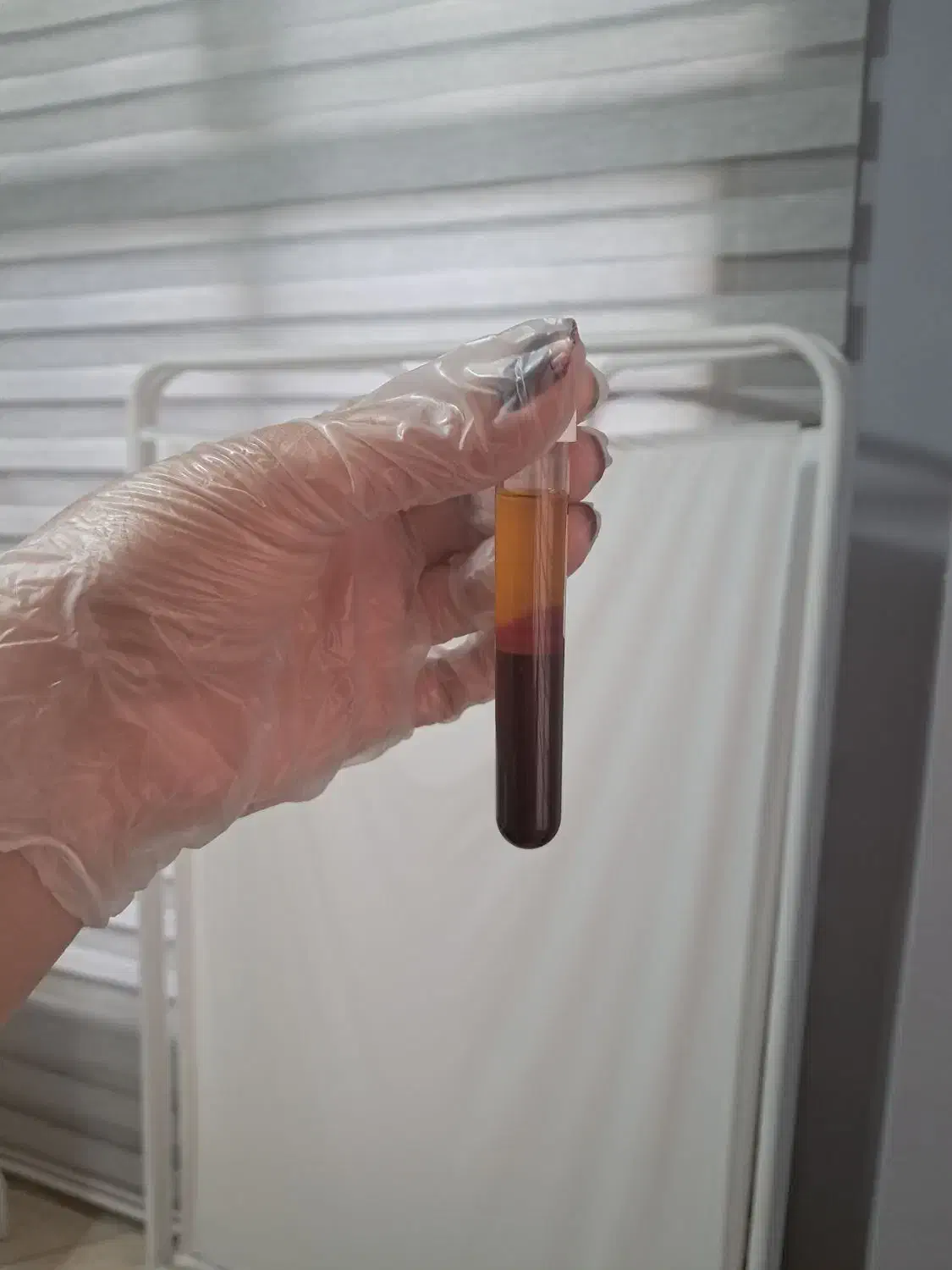 مرکز پی آر پی ،مزوتراپی ،سلول درمانی ،زانو،بوتاکس|خدمات آرایشگری و زیبایی|کرج, عظیمیه|دیوار