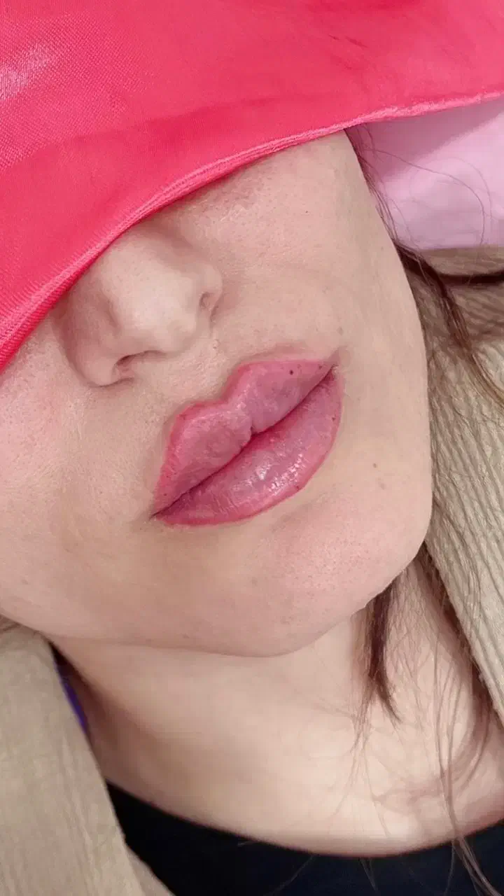 جشنواره پاییزی تخفیف ژل و بوتاکس توسط پزشک|خدمات آرایشگری و زیبایی|یاسوج, |دیوار