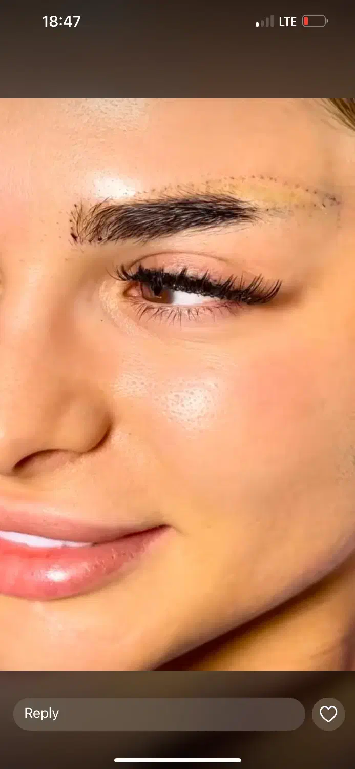 کاشت ابرو ۱۲ملیون لابیا۱۰ملیون بلفارو۱۲ملیون|خدمات آرایشگری و زیبایی|تهران, تهرانسر شمالی|دیوار