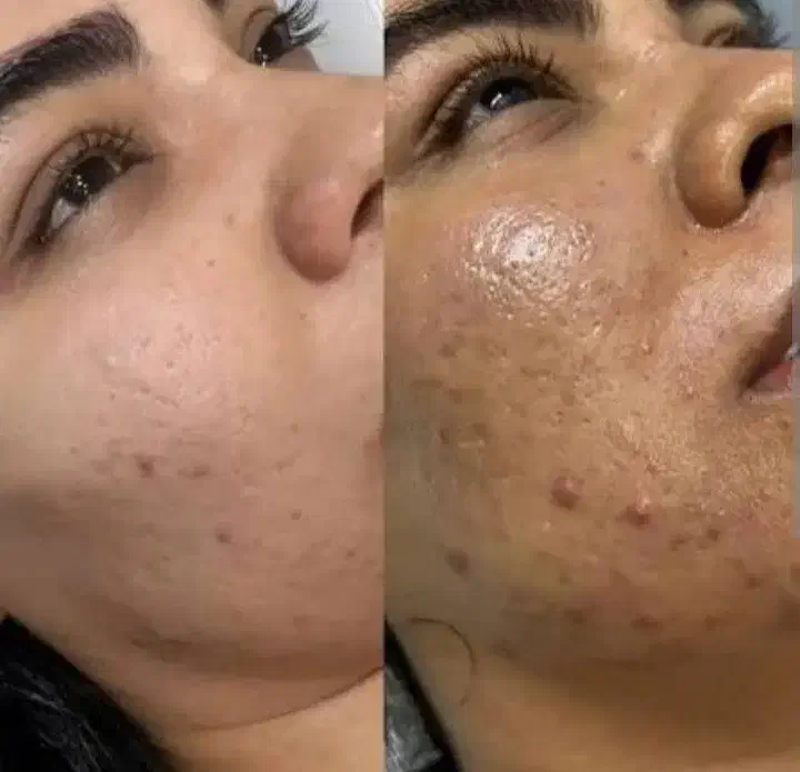 فرصتی درآمدی برای فشیال کارها کلینیک ها سالن دارها|استخدام درمانی، زیبایی، بهداشتی|محمدشهر, محمدشهر|دیوار