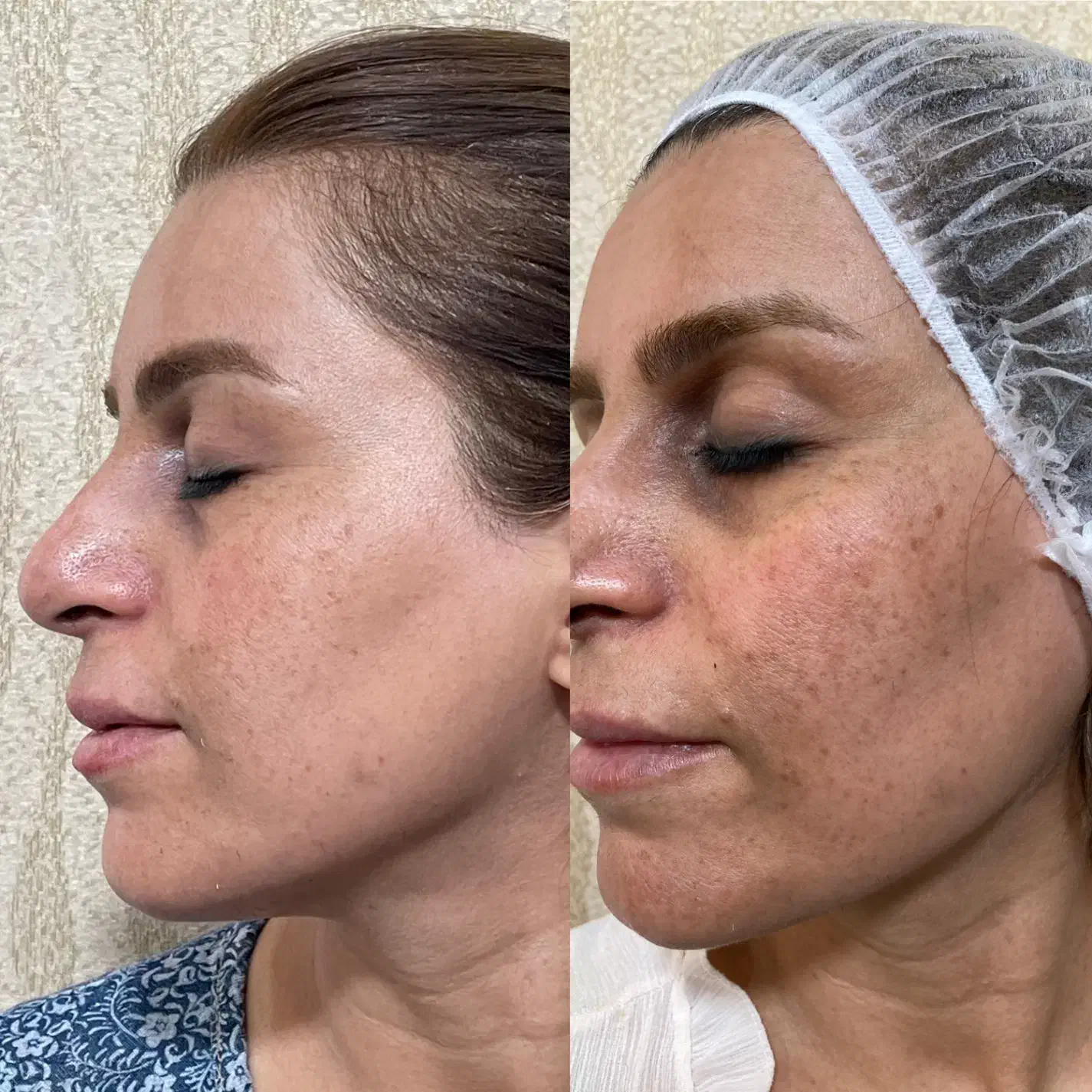 خدمات و آموزش تخصصی پوست و زیبایی|خدمات آرایشگری و زیبایی|شیراز, ارم|دیوار