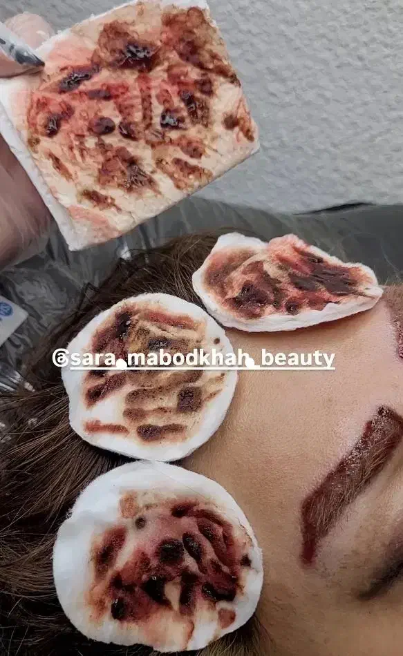 ریمووپاک کردن تتوتاتوابروصورت بدن|خدمات آرایشگری و زیبایی|رشت, فلسطین|دیوار