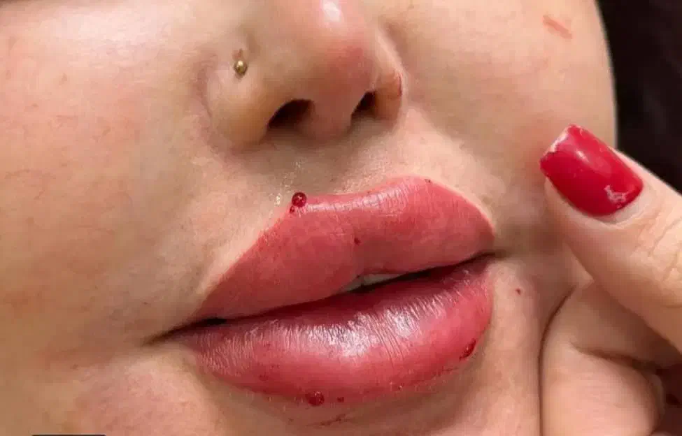 جشنواره ژل و بوتاکس و فیلر بادی و لیفت صورت|خدمات آرایشگری و زیبایی|تهران, صادقیه|دیوار