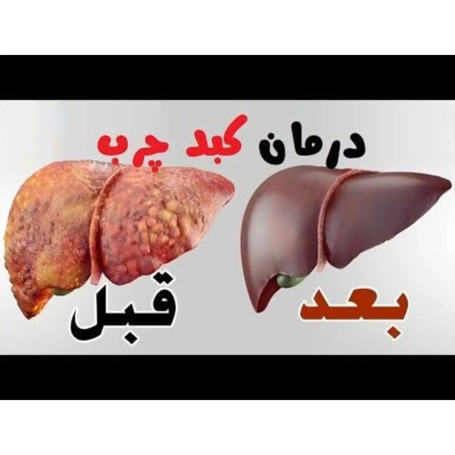 مشاوره کبدچرب و چاقی|خدمات آموزشی|مشهد, بهمن|دیوار