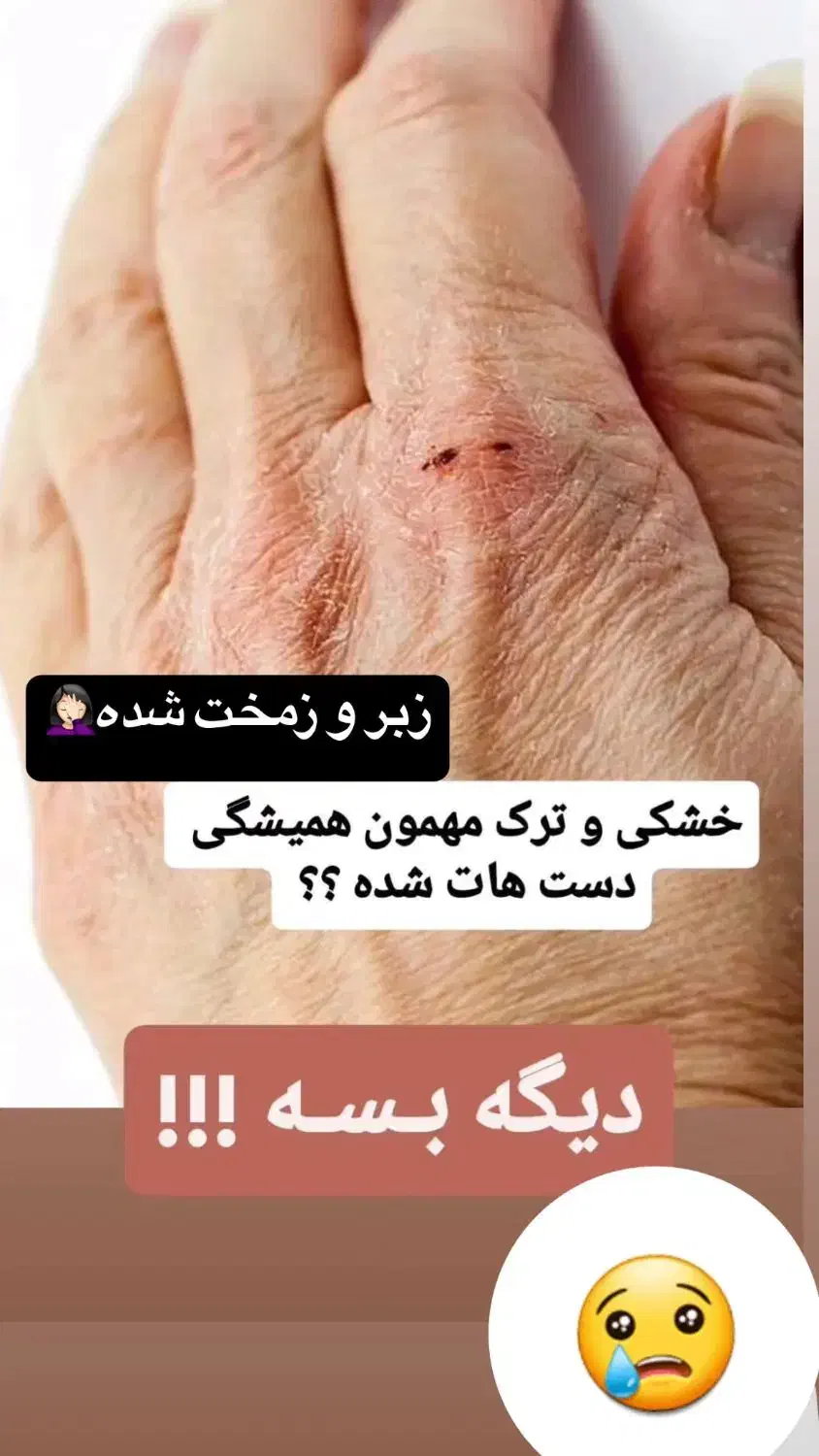 کرم جوانساز پوست دست و صورت|آرایشی، بهداشتی، درمانی|شیراز, بازار|دیوار