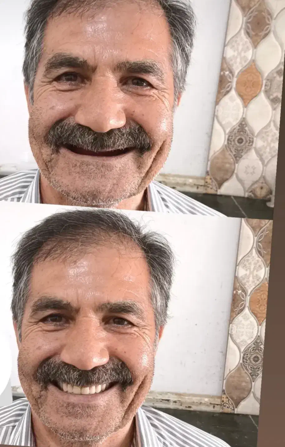 ساخت انواع دندانهای مصنوعی و متحرک|خدمات آرایشگری و زیبایی|شیراز, پودنک|دیوار