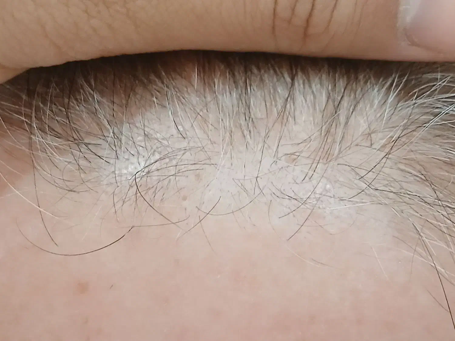 هیرفیلر مو دکتر CYJ|خدمات آرایشگری و زیبایی|تهران, تهرانسر غربی|دیوار