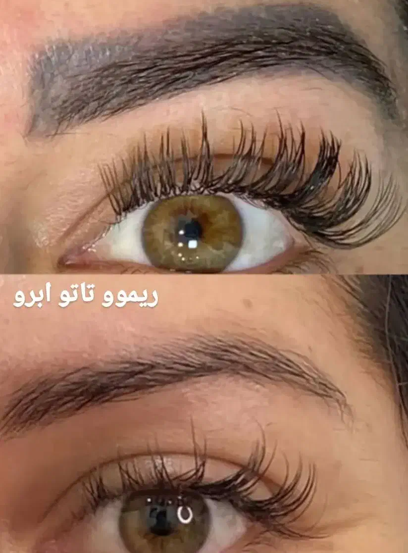 ریمو ابرو بدون زخم|خدمات آرایشگری و زیبایی|دهدشت, |دیوار