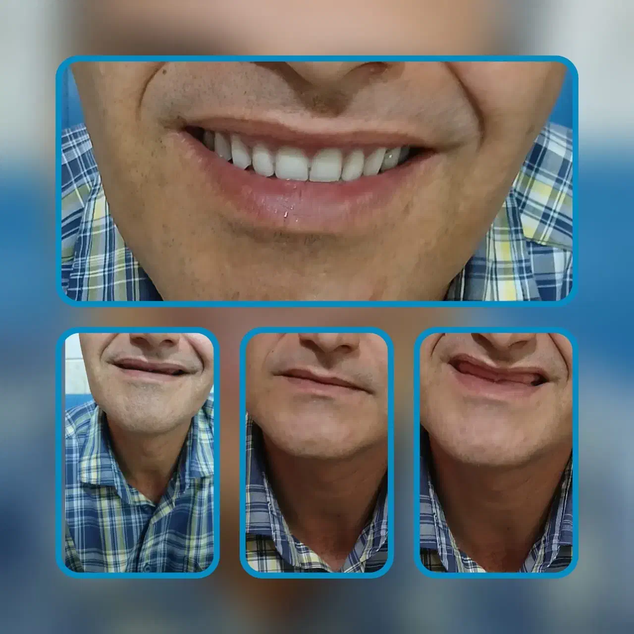 دندانپزشکی،دندانسازی|خدمات آرایشگری و زیبایی|دشتابی, |دیوار