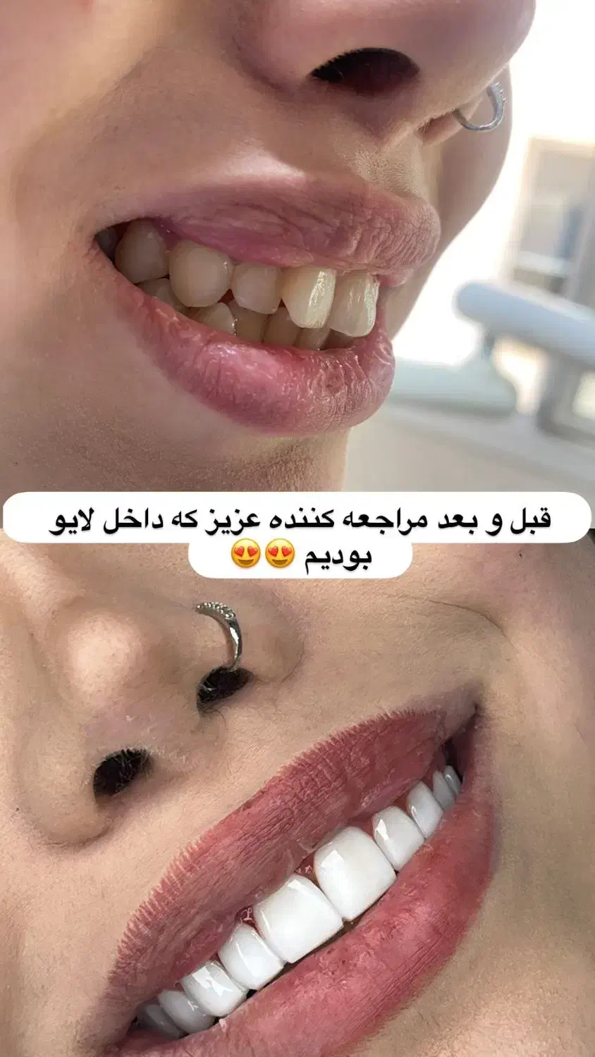 کامپوزیت تخفیف|خدمات آرایشگری و زیبایی|خرم‌آباد, |دیوار