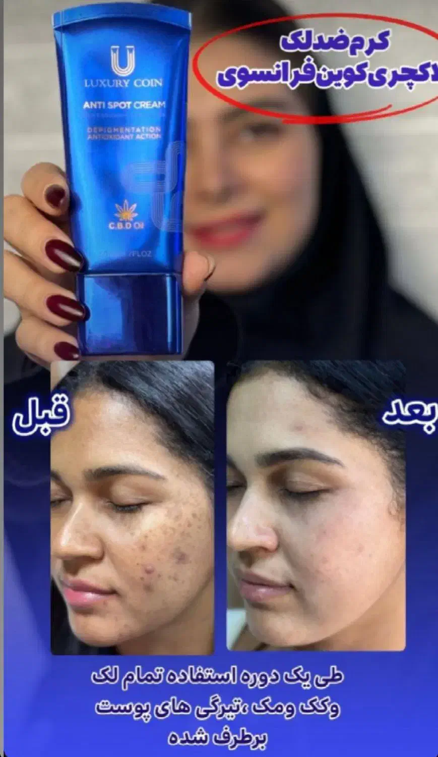 زیبایی صورت|آرایشی، بهداشتی، درمانی|خاش, |دیوار