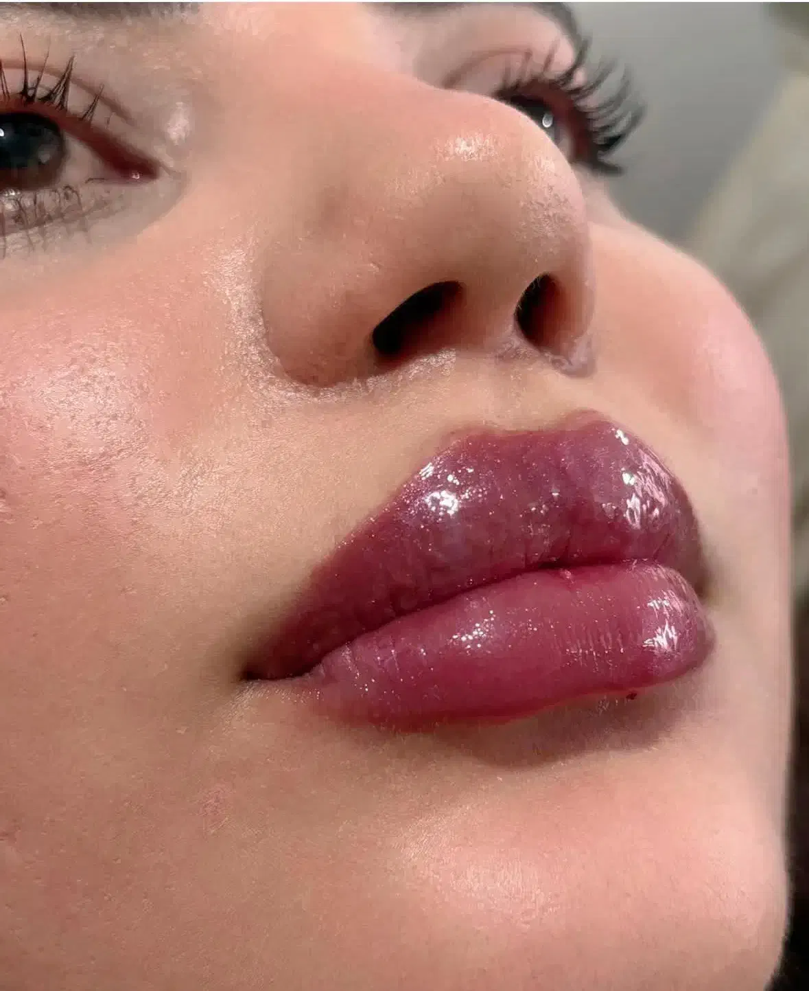 تزریق فیلر،ژل لب،فیلربینی|خدمات آرایشگری و زیبایی|شیراز, ریشمک|دیوار