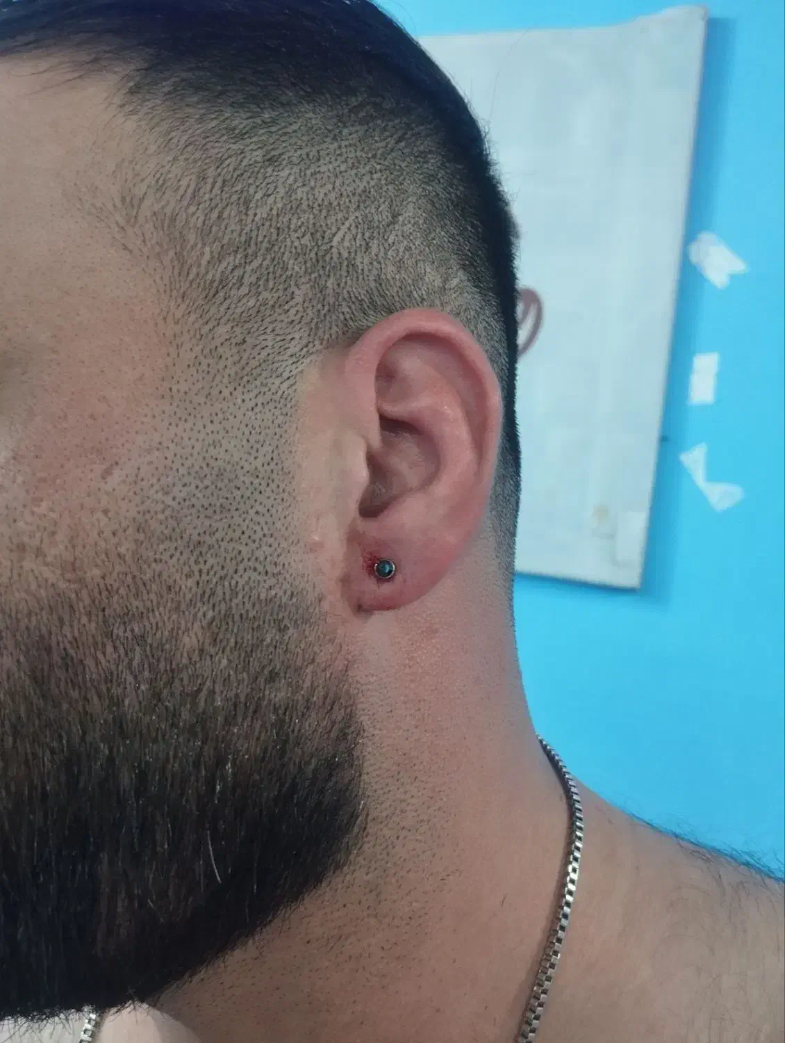 اصلاح خالبرداری لیزری پرسینگ گوش پاکسازی کامل پوست|خدمات آرایشگری و زیبایی|محمودآباد, |دیوار