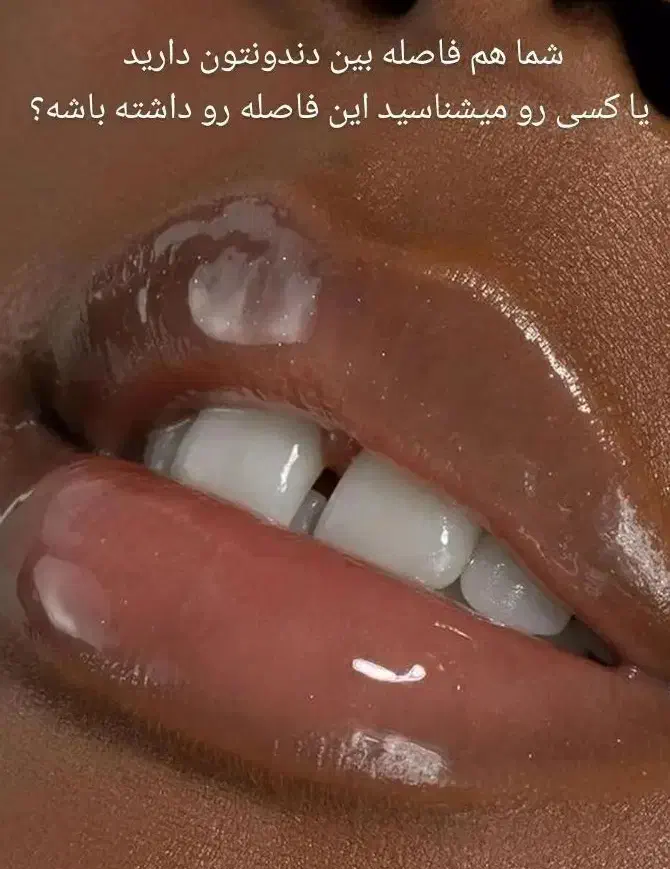 ترمیم و پر کردن دندان فقط ۱ میلیون و ۳۰۰|خدمات آرایشگری و زیبایی|ورامین, خیر آباد|دیوار