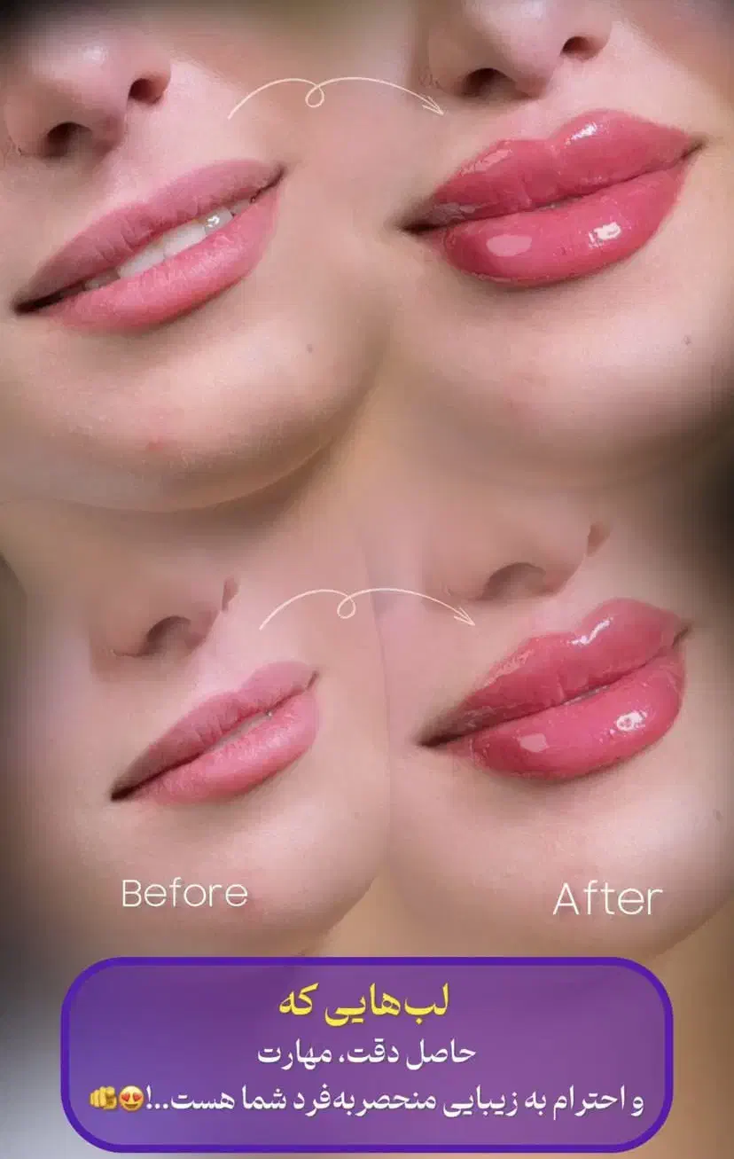 خدمات زیبایی با قیمت استثنایی|خدمات آرایشگری و زیبایی|زنجان, |دیوار