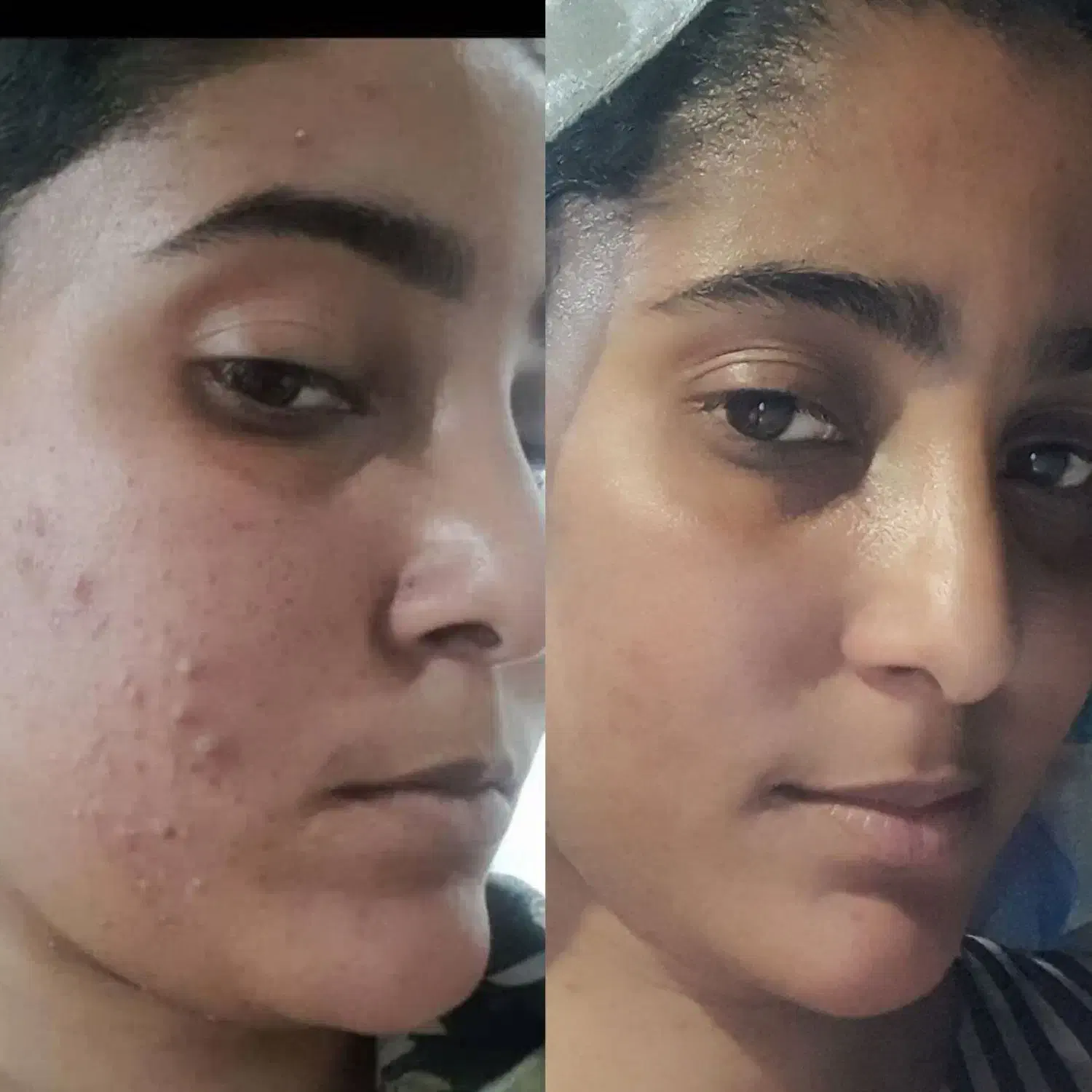 پاکسازی صورت با قیمت مناسب فقط فقط بانوان|آرایشی، بهداشتی، درمانی|مشگین شهر, |دیوار