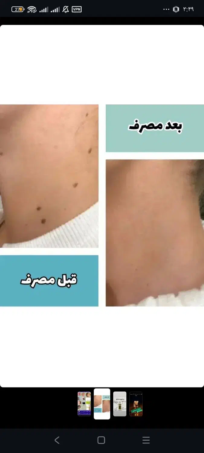 درمان|آرایشی، بهداشتی، درمانی|شهرکرد, |دیوار