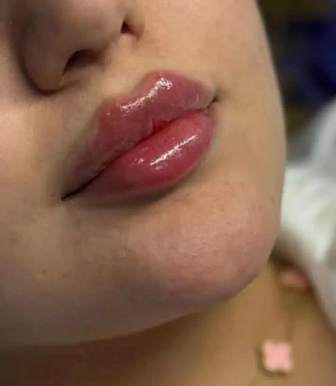 جشنواره خدمات حرفه ای درمان پوست و مو|خدمات آرایشگری و زیبایی|بستان آباد, |دیوار