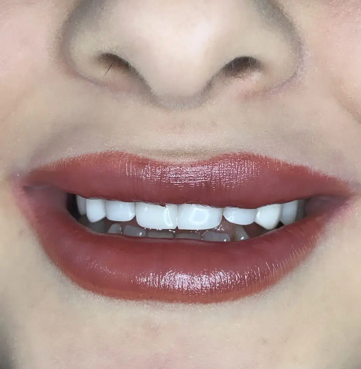 دندان پزشکی لبخند سفید|خدمات آرایشگری و زیبایی|ماهنشان, |دیوار