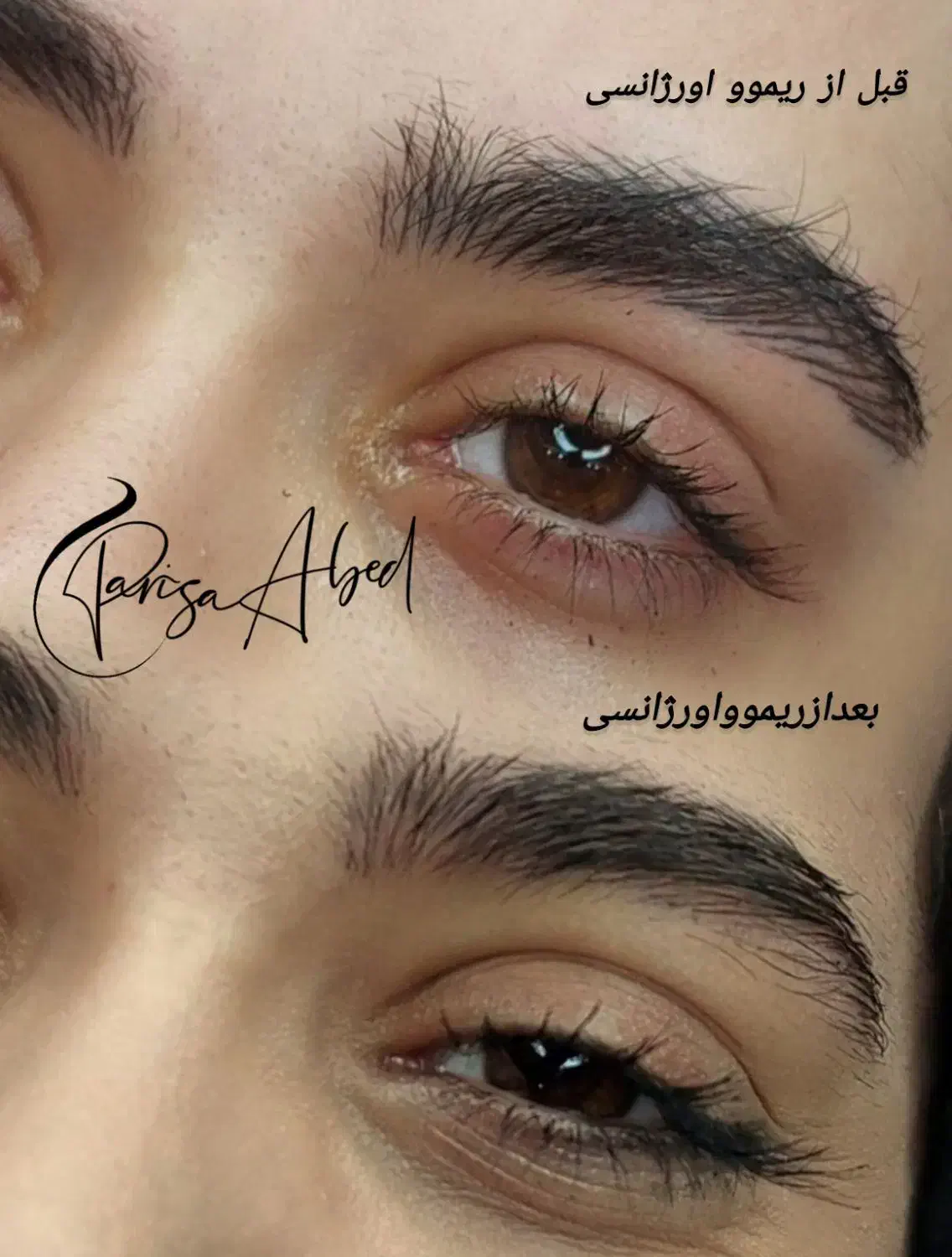 ریموو لب،ریموو خط لب،ریموو خط چشم،ریموو تتو ابرو|خدمات آرایشگری و زیبایی|اسلام‌شهر, مطهری|دیوار