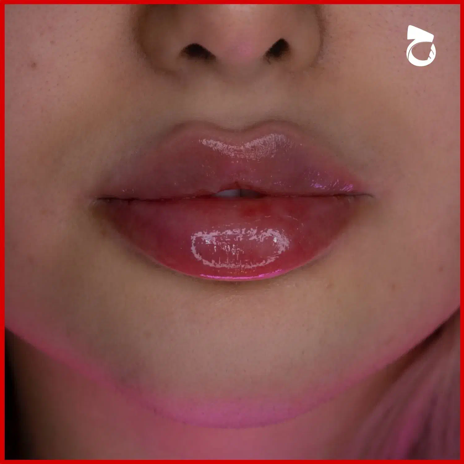 تخفیفات ۵۰ درصدی ژل و بوتاکس و فیلر دکتر زیبایی|خدمات آرایشگری و زیبایی|مشهد, شهید فرامرز عباسی|دیوار