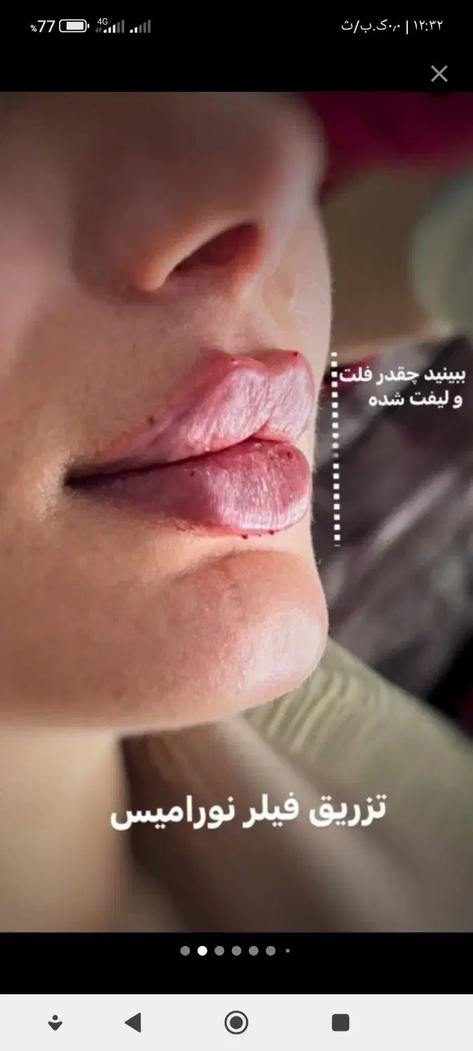 پانسمان وجراحی های سرپایی،ختنه،زگیل تناسلی|خدمات آرایشگری و زیبایی|اهواز, شریعتی جنوبی|دیوار