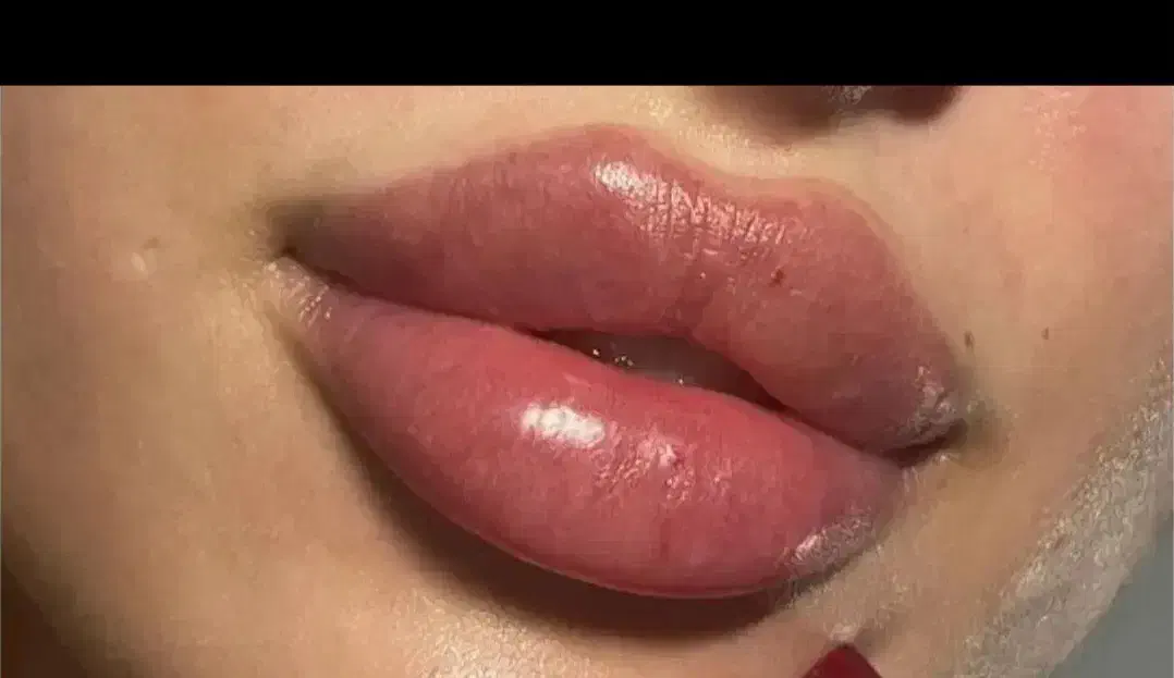 ژل و بوتاکس و مزو ژل|خدمات آرایشگری و زیبایی|بومهن, |دیوار