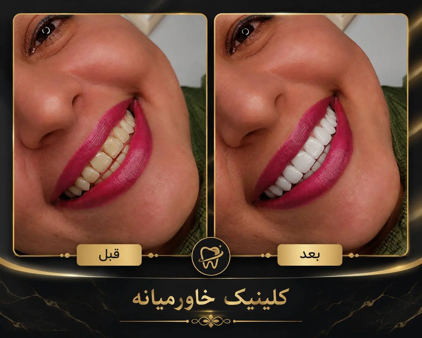 بزرگترین جشنواره سال دندانپزشکی درمجهزترین کلینیک|خدمات زیبایی و سلامت|شیراز, عفیف‌آباد|دیوار