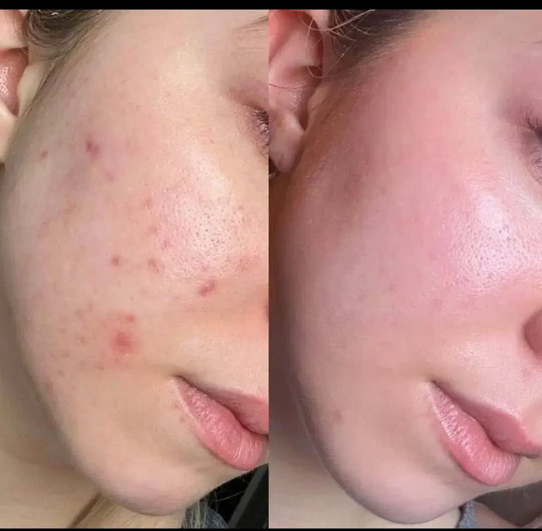 کرم سفید کننده|آرایشی، بهداشتی، درمانی|زابل, |دیوار