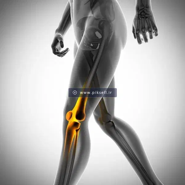 درد  در زانو|فعالیت داوطلبانه|اصفهان, آبشار|دیوار