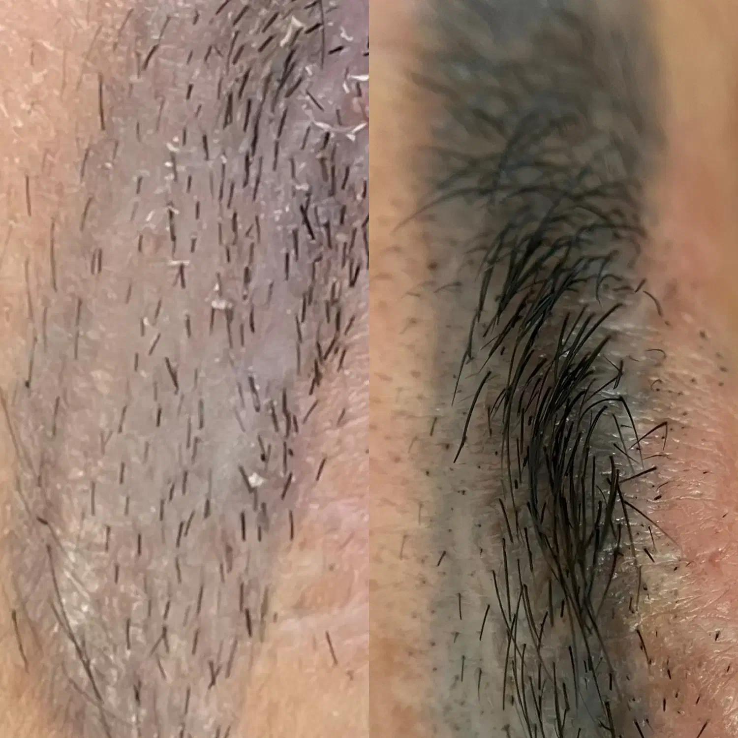 نیازمند مدل ریموو|خدمات آرایشگری و زیبایی|کرمانشاه, |دیوار