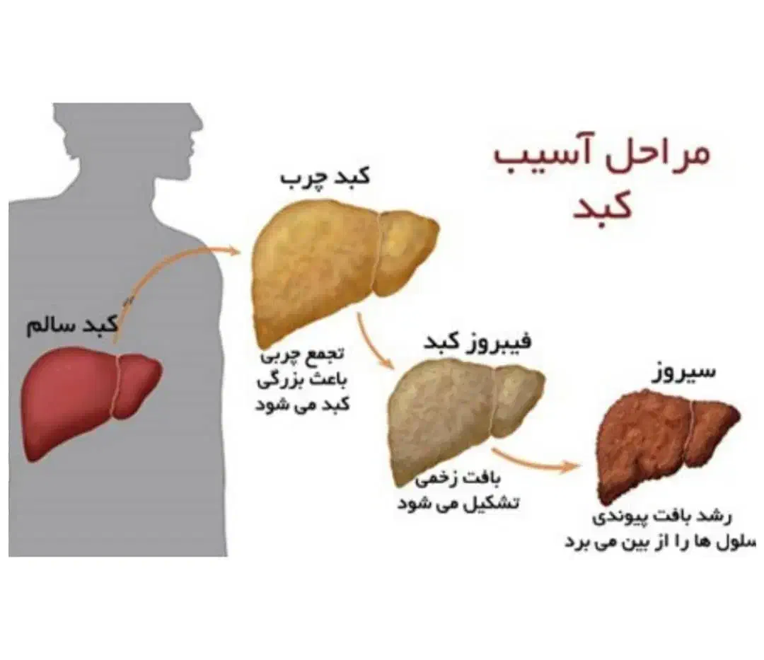 کبد پاک|آرایشی، بهداشتی، درمانی|اردبیل, |دیوار
