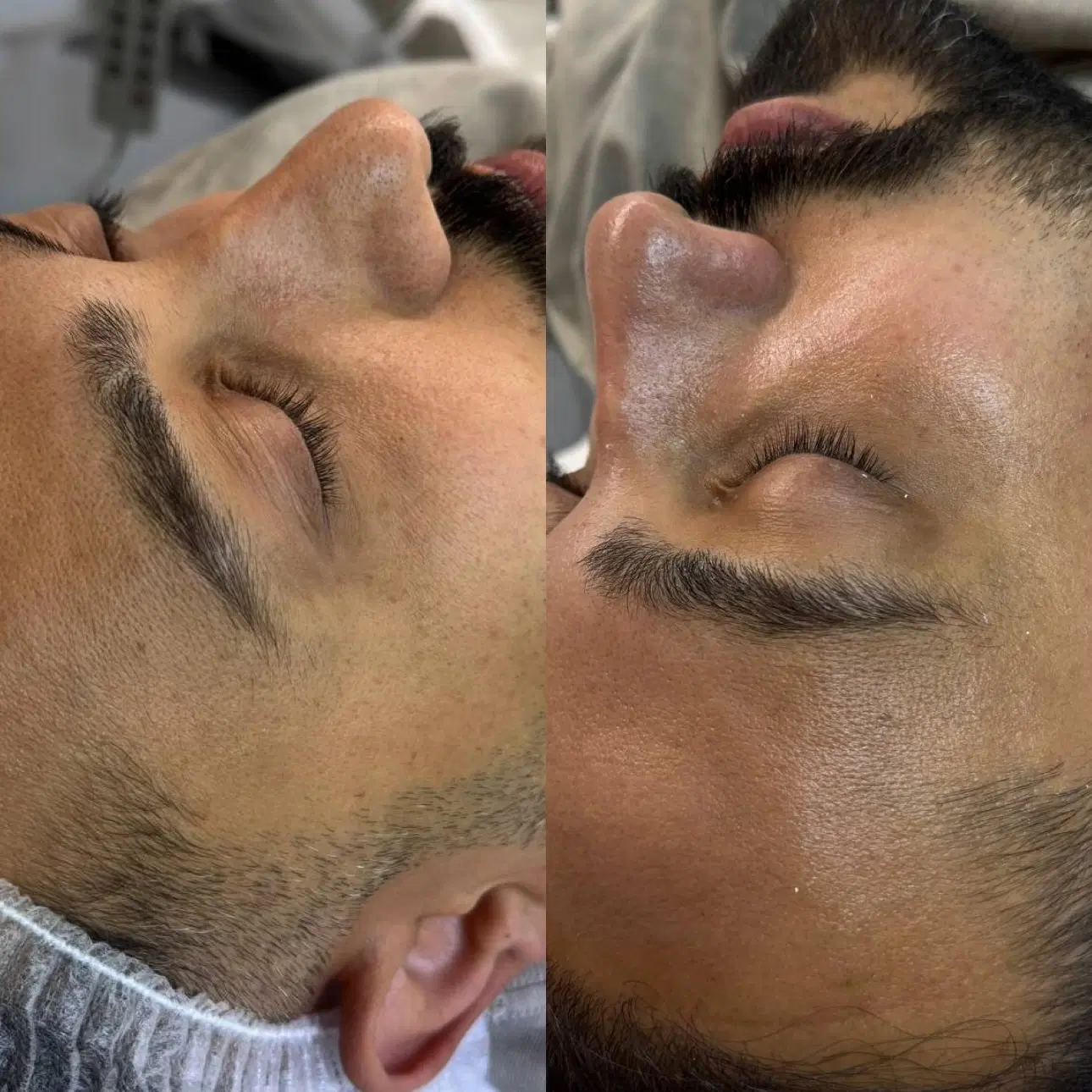 فیشال تخصصی پوست، پاکسازی و آبرسانی|خدمات زیبایی و سلامت|تهران, شمسآباد|دیوار