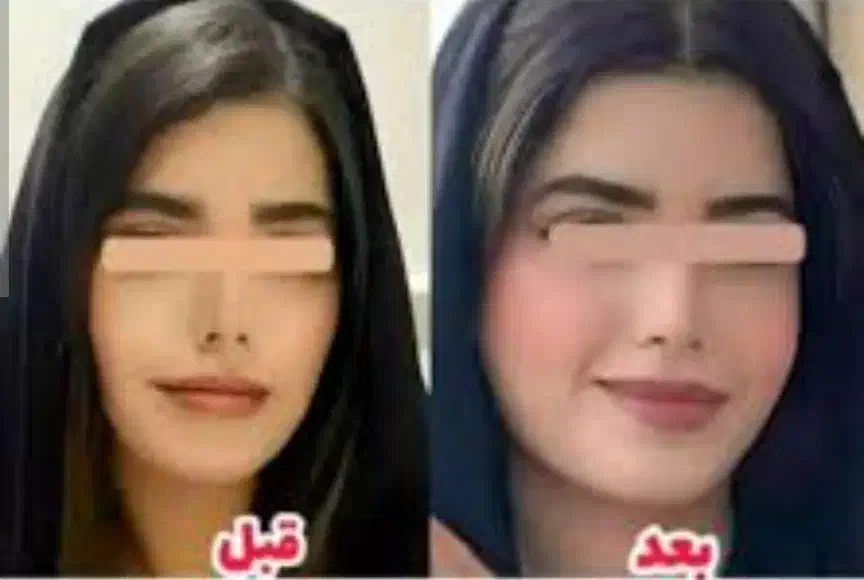 بمب چاقی صورت|خوردنی و آشامیدنی|شیراز, عفیف‌آباد|دیوار