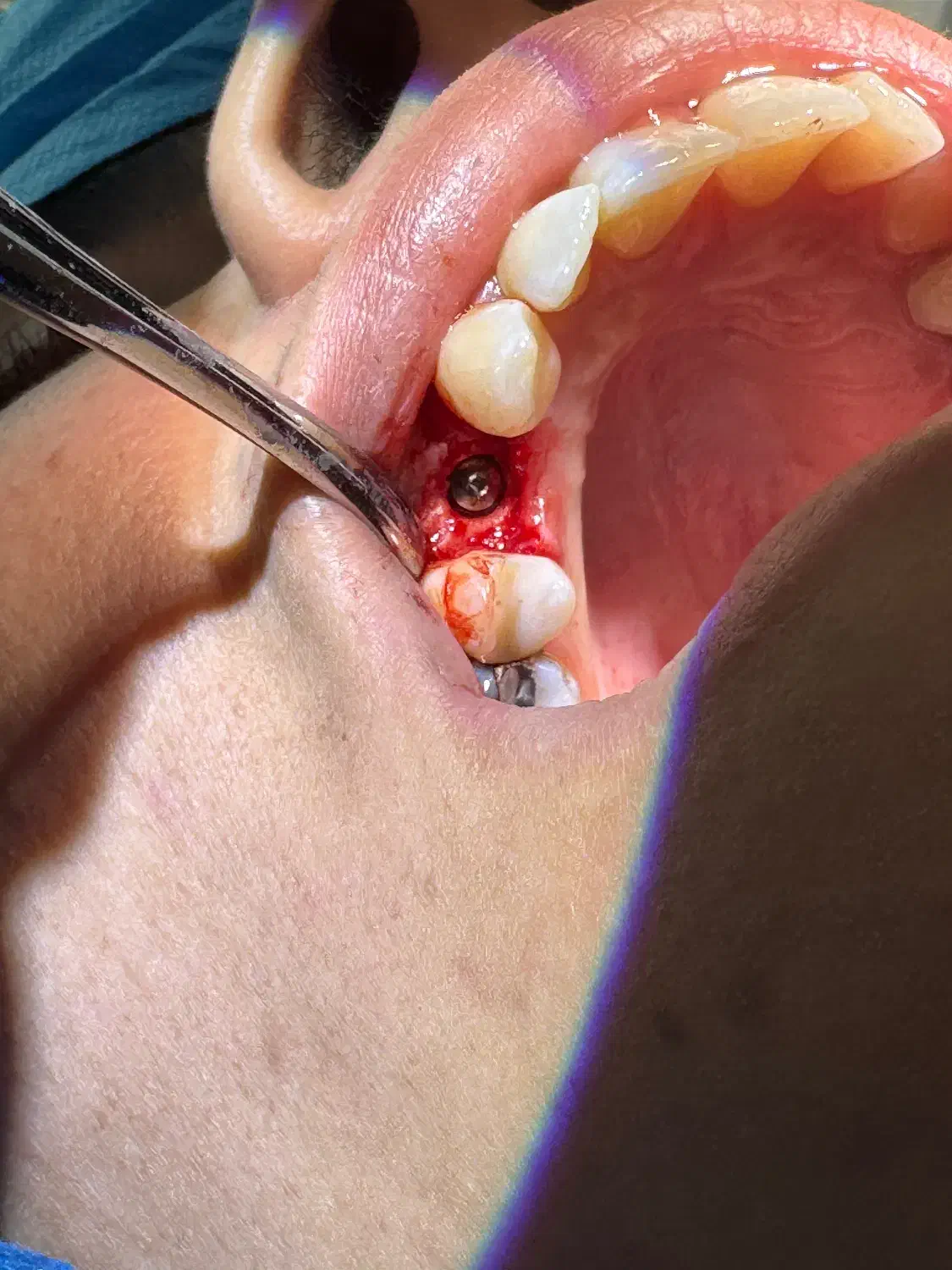 مطب دندانپزشکی بیمه ملت (شهرداری)|خدمات آرایشگری و زیبایی|ارومیه, |دیوار