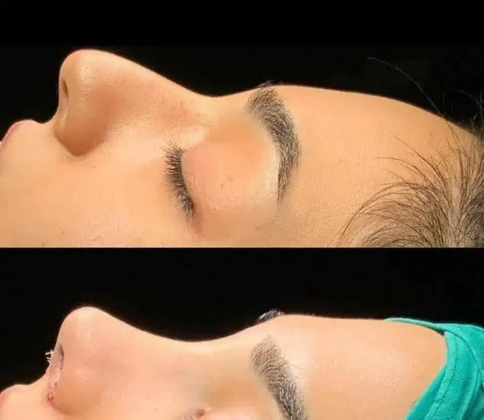 جراحی عمل بینی/لیپو ابدو/بلفارو/لیفت/لیپو ساکشن|خدمات آرایشگری و زیبایی|تهران, فلسطین (میدان انقلاب)|دیوار