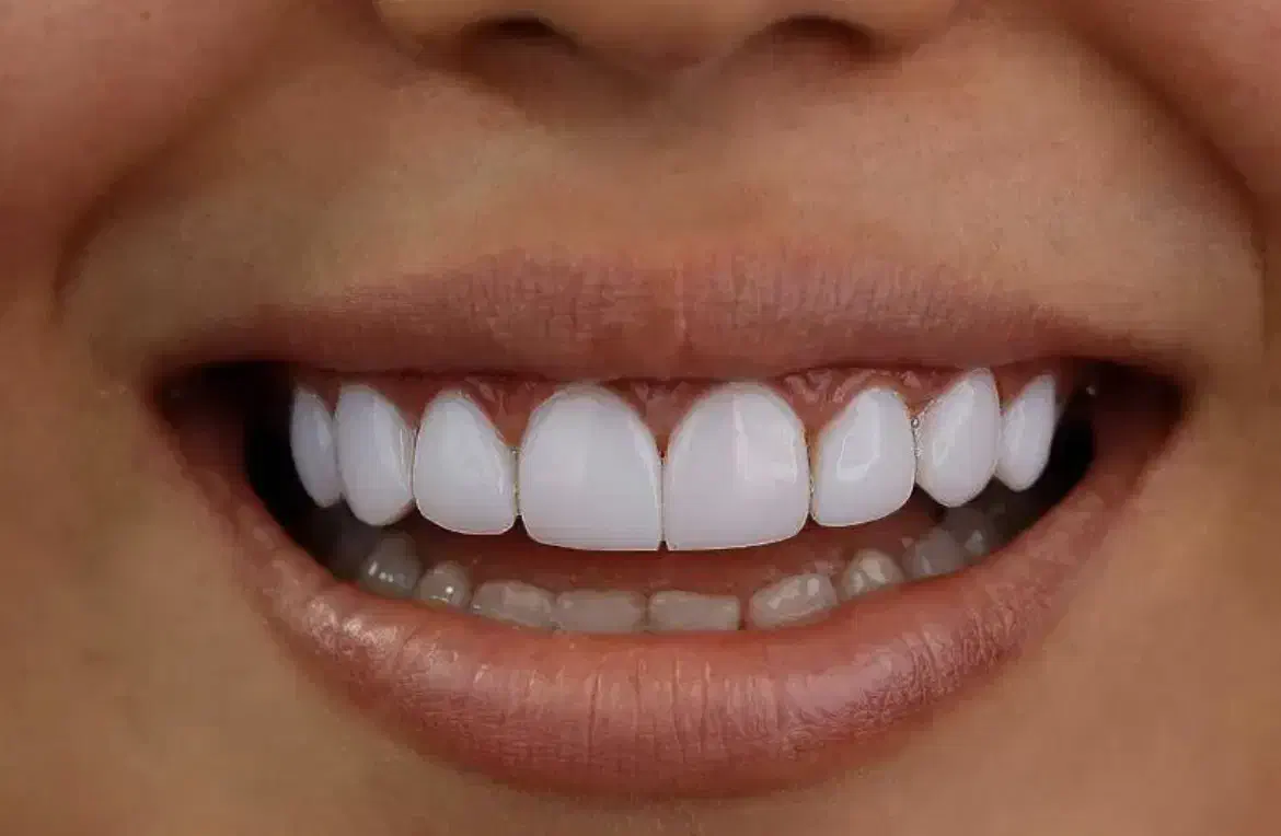 خدمات دندانپزشکی(روکش و کامپوزیت‌و..)|خدمات آرایشگری و زیبایی|گرگان, |دیوار