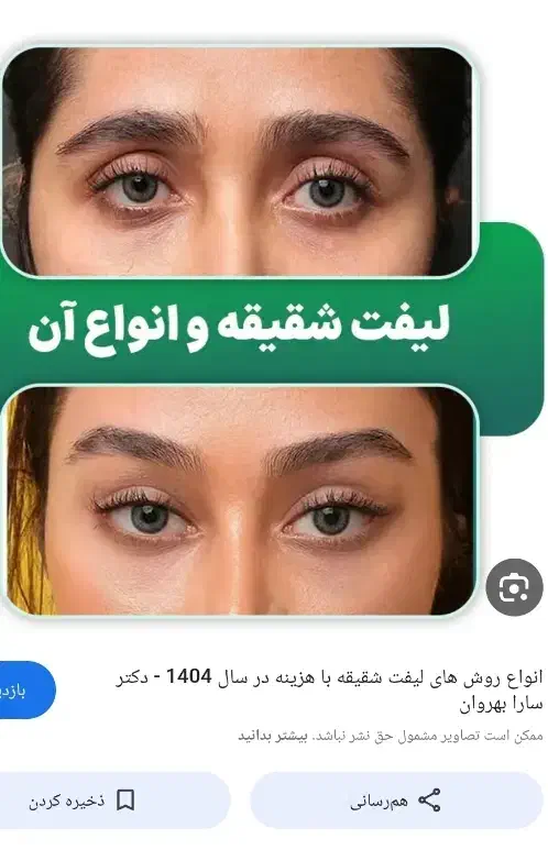 مشاوره میخوام درمورد زیبایی ل یفت شق یقه چشم ابرو|فعالیت داوطلبانه تحقیقاتی|قم, سالاریه|دیوار
