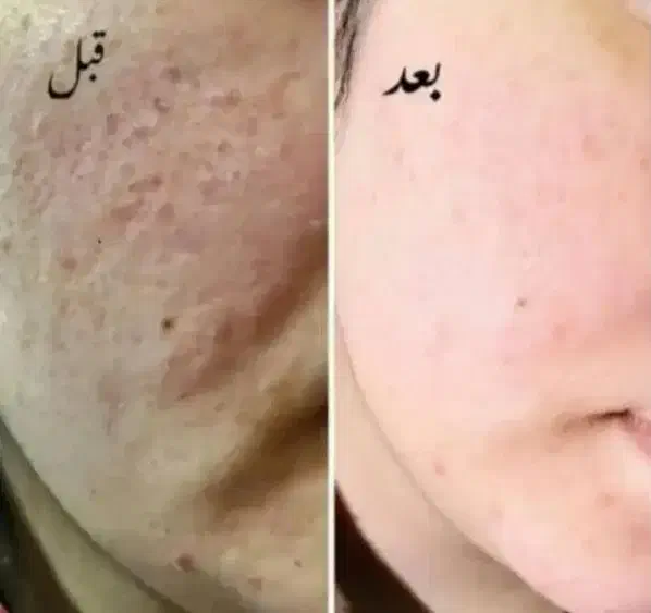 بهترین کرم vip|آرایشی، بهداشتی، درمانی|جیرفت, |دیوار