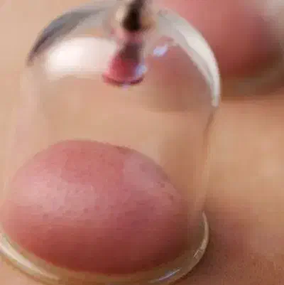 ماساژ و حجامت و بادکش گرم زالو درمانی|خدمات آرایشگری و زیبایی|زابل, |دیوار