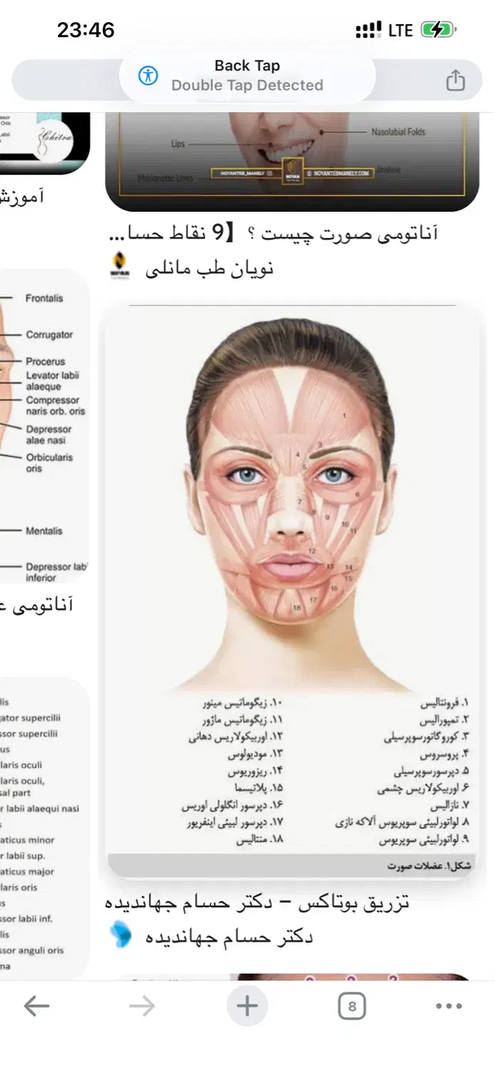 تزریق ژل وبوتاکس وprp ومزونیدلینگ وفشیال وهایفو|خدمات آرایشگری و زیبایی|امیدیه, |دیوار