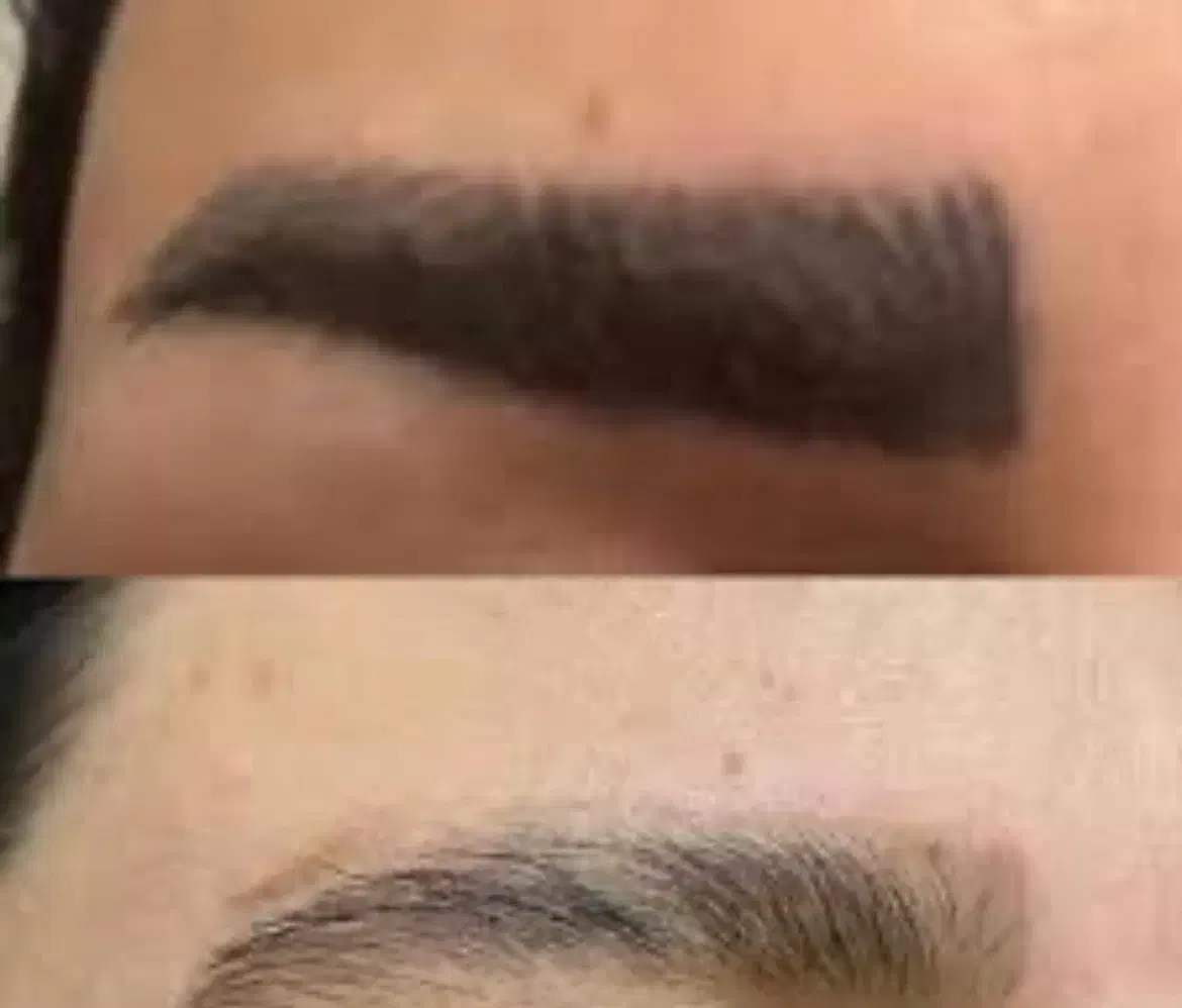 مرکز تخصصی هایفو پاک کردن تتوابرو بالیزر توسط پزشک|خدمات آرایشگری و زیبایی|مرودشت, ابوذر شمالی|دیوار