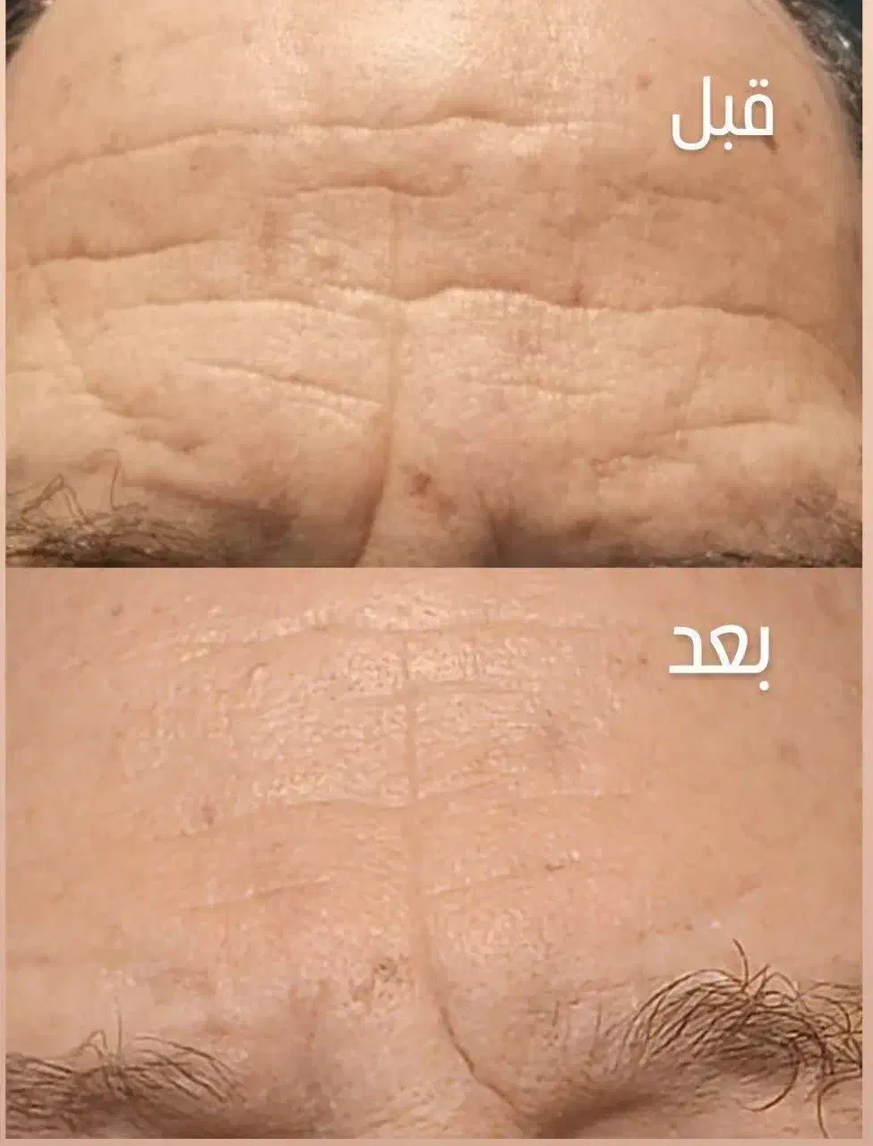 محصولات گیاهی مراقبتی پوست و مو|آرایشی، بهداشتی، درمانی|رشت, باهنر|دیوار