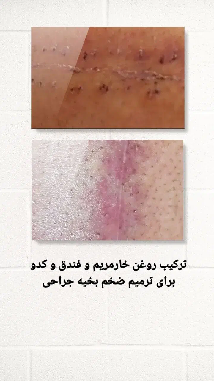 راه کار در منزل|آرایشی، بهداشتی، درمانی|لامرد, |دیوار