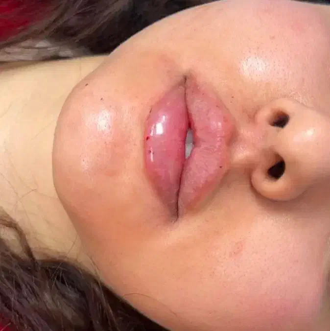 اموزش ژل و بوتاکس و پی ار پی|خدمات آموزشی|اهواز, پردیس دو|دیوار